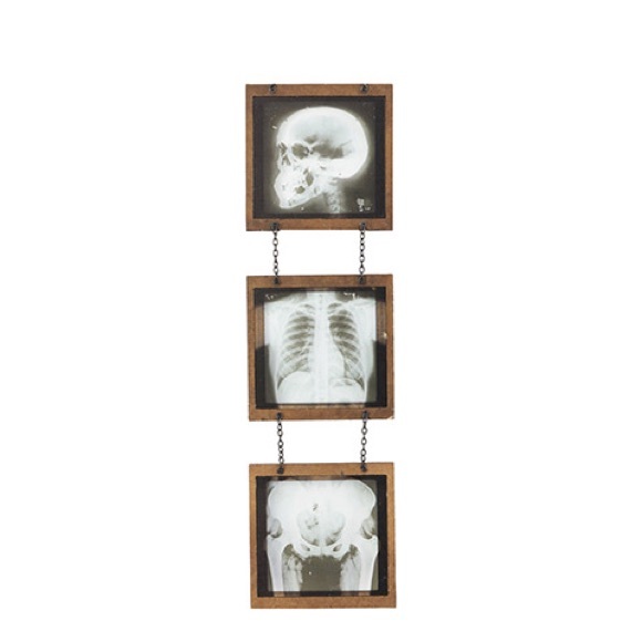 X-Ray Skeleton Wall Decor 18” - Picture 4 of 4